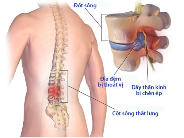 cac-kieu-dau-lung-do-ngoi-nhieu