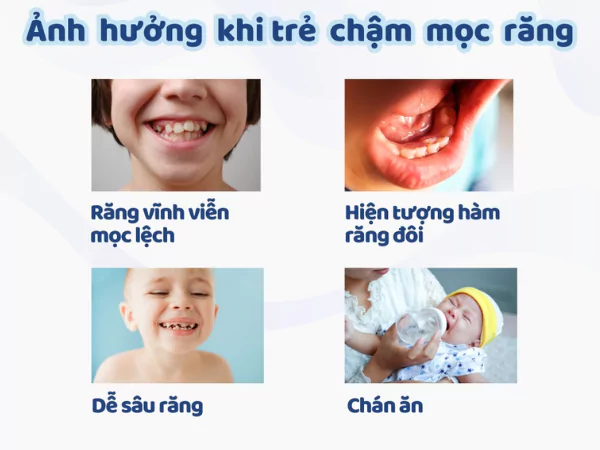 anh-huong-khi-tre-cham-moc-rang