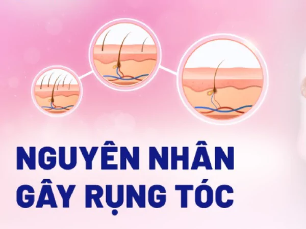 nguyen-nhan-gay-rung-toc